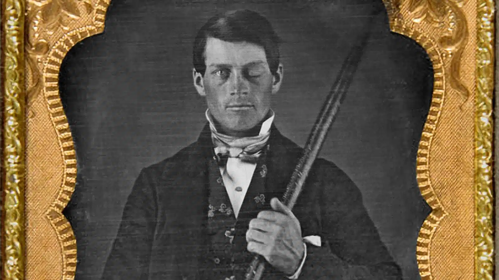 Phineas Gage: l’uomo che visse con un buco nel cervello Originally from the collection of Jack and Beverly Wilgus, and now in the Warren Anatomical Museum, Harvard Medical School., CC BY-SA 3.0 , via Wikimedia Commons