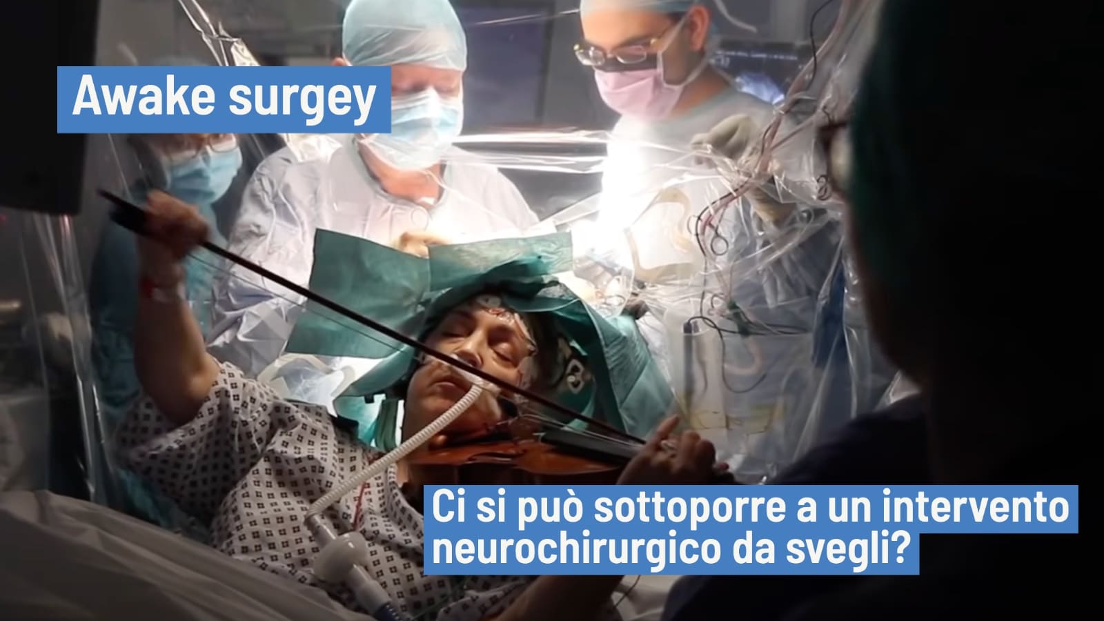 Awake surgery sottoporsi da svegli a un operazione chirurgica